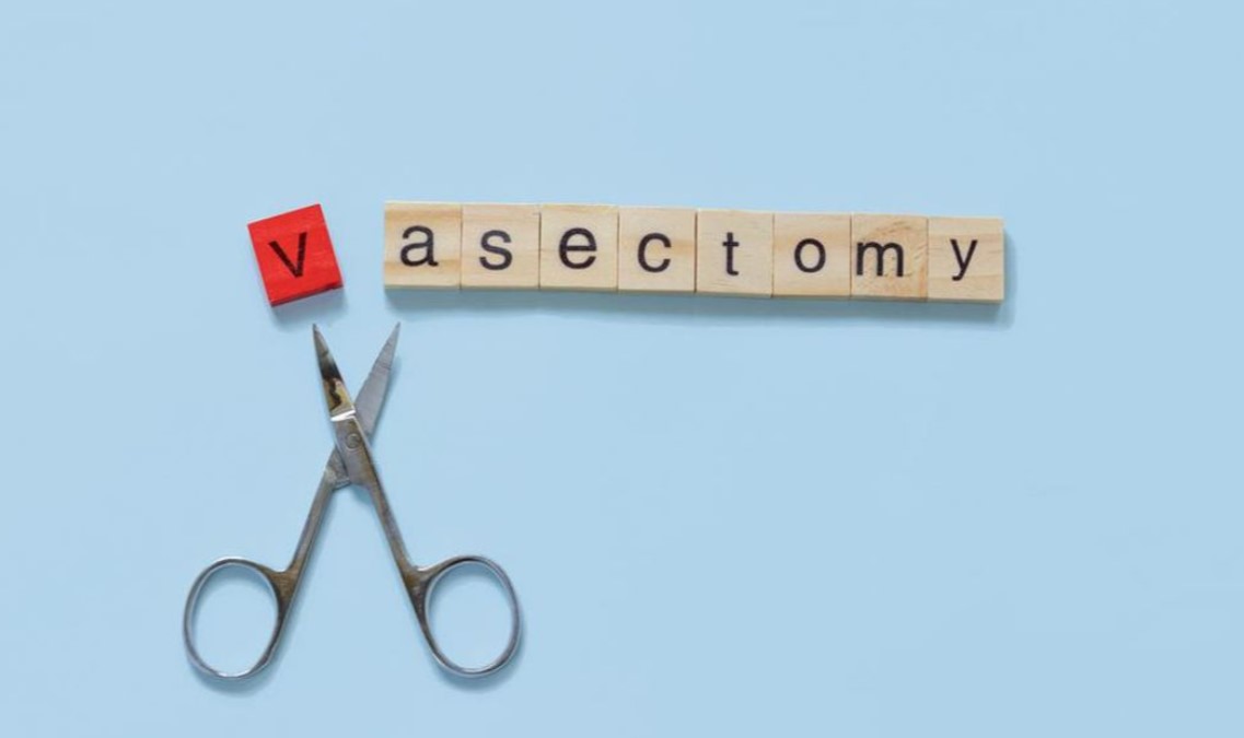 vasectomy